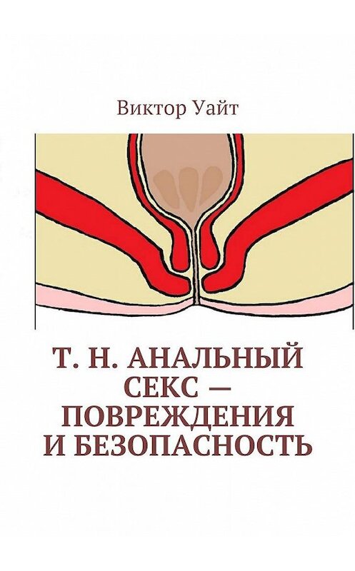 Обложка книги «Т. н. анальный секс – повреждения и безопасность» автора Виктора Уайта. ISBN 9785447475635.