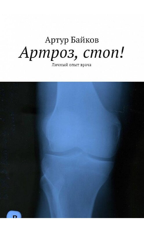 Обложка книги «Артроз, стоп! Личный опыт врача» автора Артура Байкова. ISBN 9785449045447.