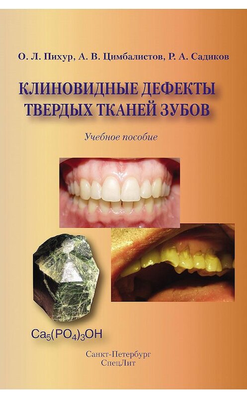 Обложка книги «Клиновидные дефекты твердых тканей зубов» автора . ISBN 9785299004786.