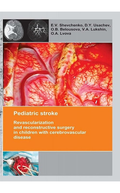 Обложка книги «Pediatric stroke. Revascularization and reconstructive surgery in children with cerebrovascular disease» автора . ISBN 9785449342652.